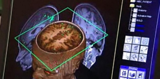 Brain tissue grown on semiconductor chip