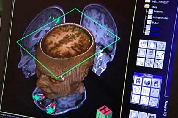 Brain tissue grown on semiconductor chip