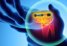 Implanting chips in employees signals change in the future of work rfid-implants-realtime-feature
