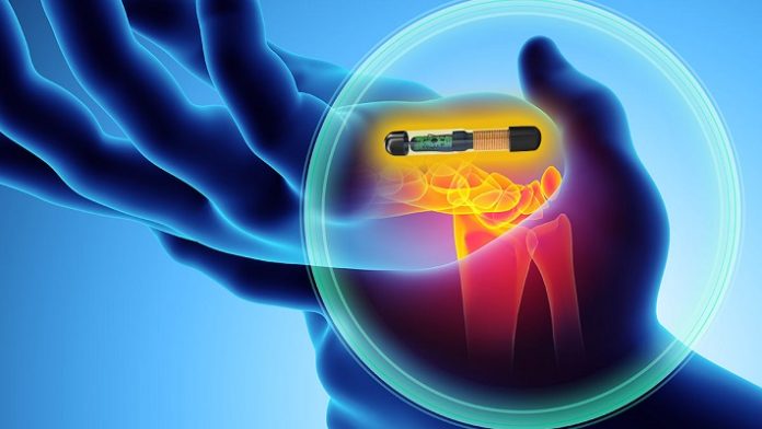 rfid-implants-realtime-feature