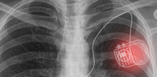 medical implant technology