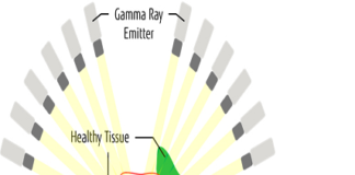 Radiation Treatment for Diseases