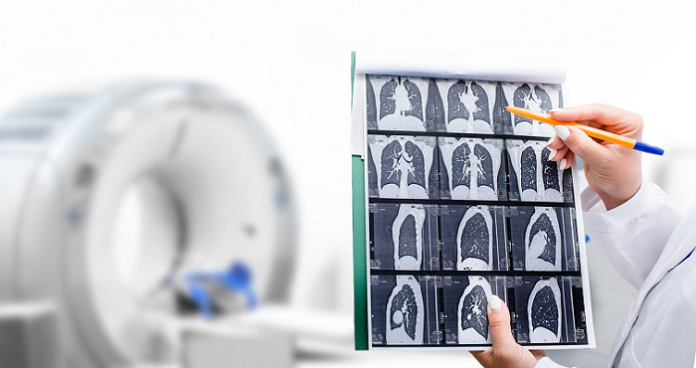 AI-Based Simulator for Diagnosing Interstitial Lung Diseases
